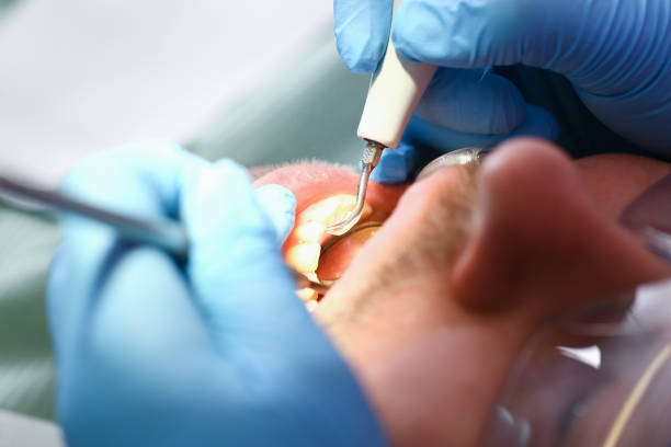 Best Emergency Dentist for Lost Fillings or Crowns in Winslow, AZ