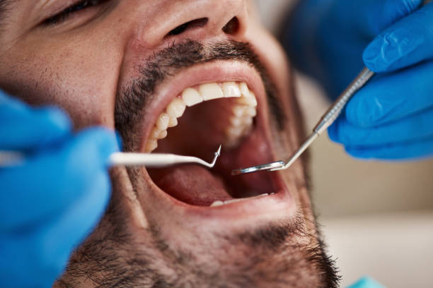 Best Broken or Cracked Tooth Emergency Dentist in Winslow, AZ